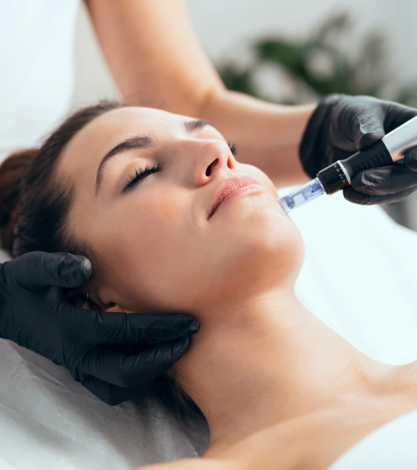 microneedling