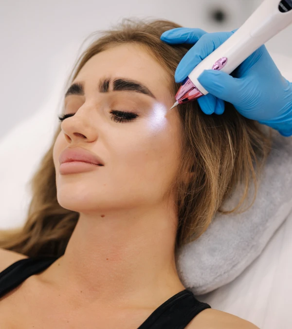 microneedling